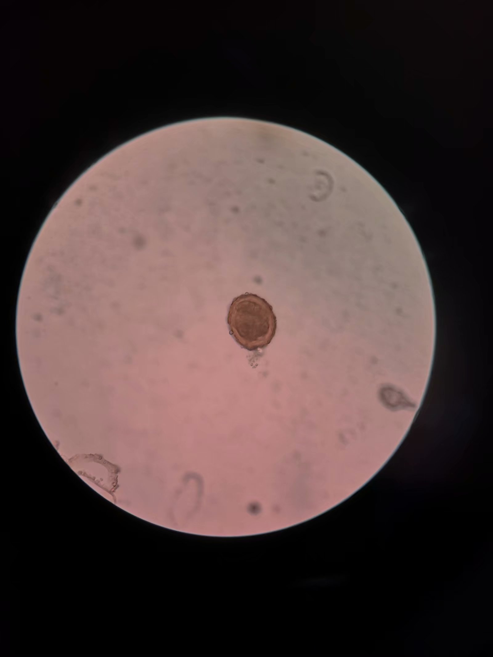 显微镜下的蛔虫卵图片-商业图片-正版原创图片下载购买-VEER图片库