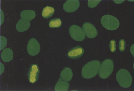 均质型(H),HEp-2细胞，FITC染色，X200