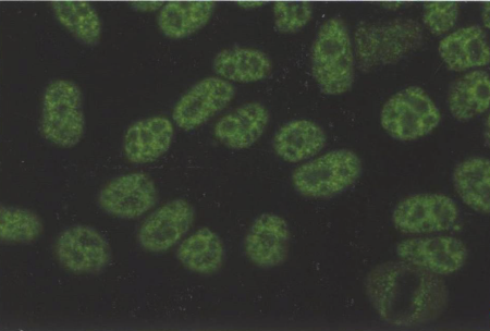 斑点型(S),HEp-2细胞，FITC染色，X200