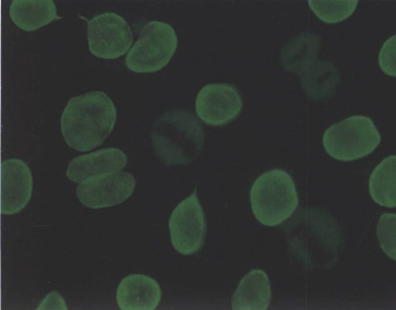 核膜型或周边型(M),HEp-2细胞，FITC染色，X200