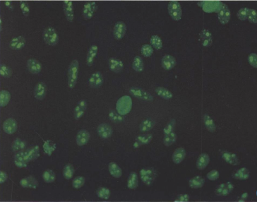 核仁型(N),HEp-2细胞，FITC染色，X200