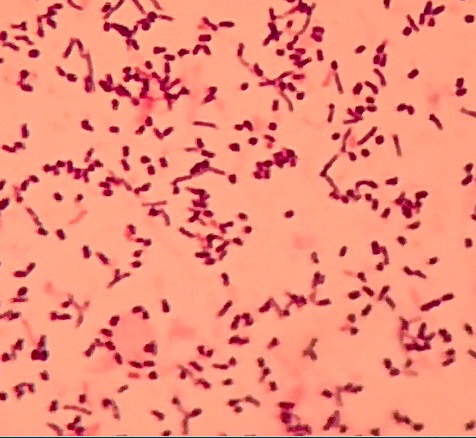 链球菌革兰氏染色绘图图片