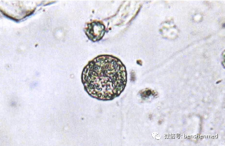 复粒细胞 X400