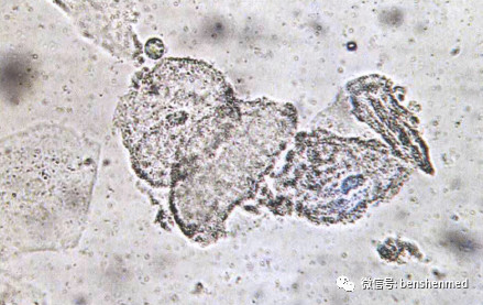 线索细胞X400