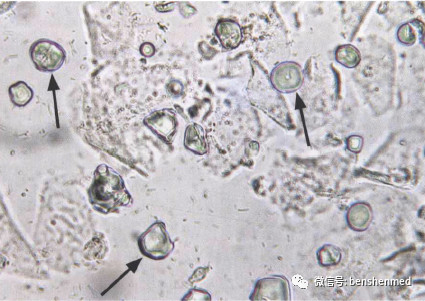 淀粉颗粒X400