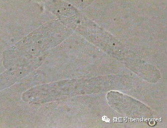 透明管型